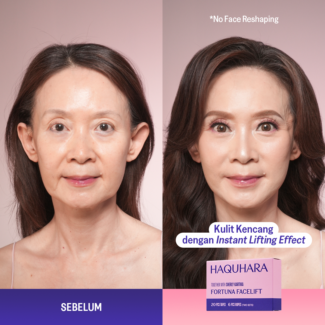 Fortuna Facelift x Sherly Kartika