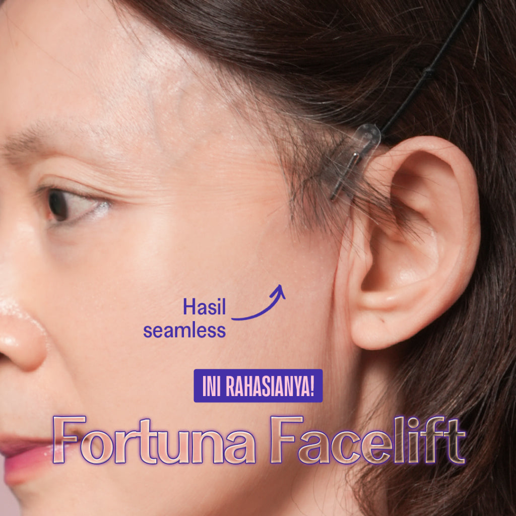 [HANYA TALI / ROPES ONLY] Haquhara Fortuna Facelift X Sherly Kartika / Tali Pengait Facelift